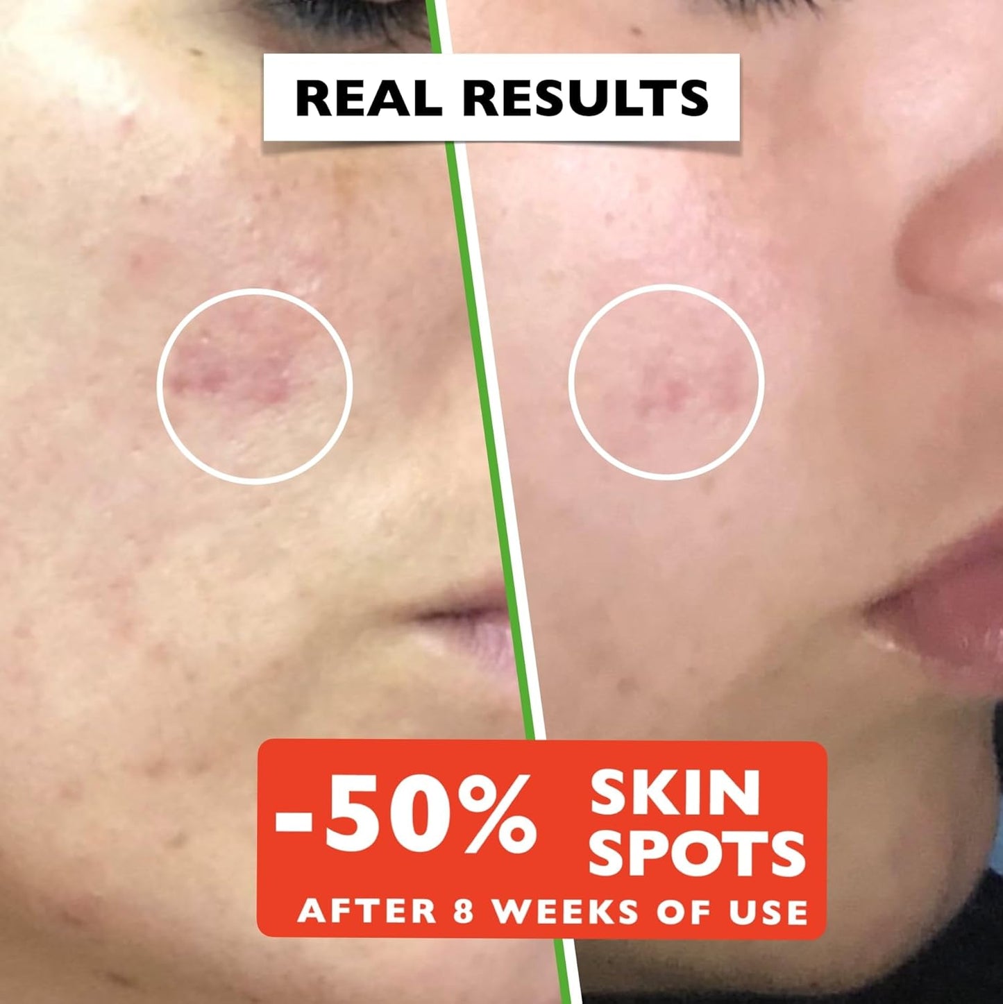 Big 2.11oz. Organic Vitamin C Serum for Face. Anti-Dark Spots, Wrinkles Skin Repair, Anti Aging Facial & Eye Area Skincare