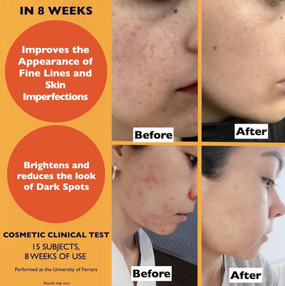 Big 2.11oz. Organic Vitamin C Serum for Face. Anti-Dark Spots, Wrinkles Skin Repair, Anti Aging Facial & Eye Area Skincare